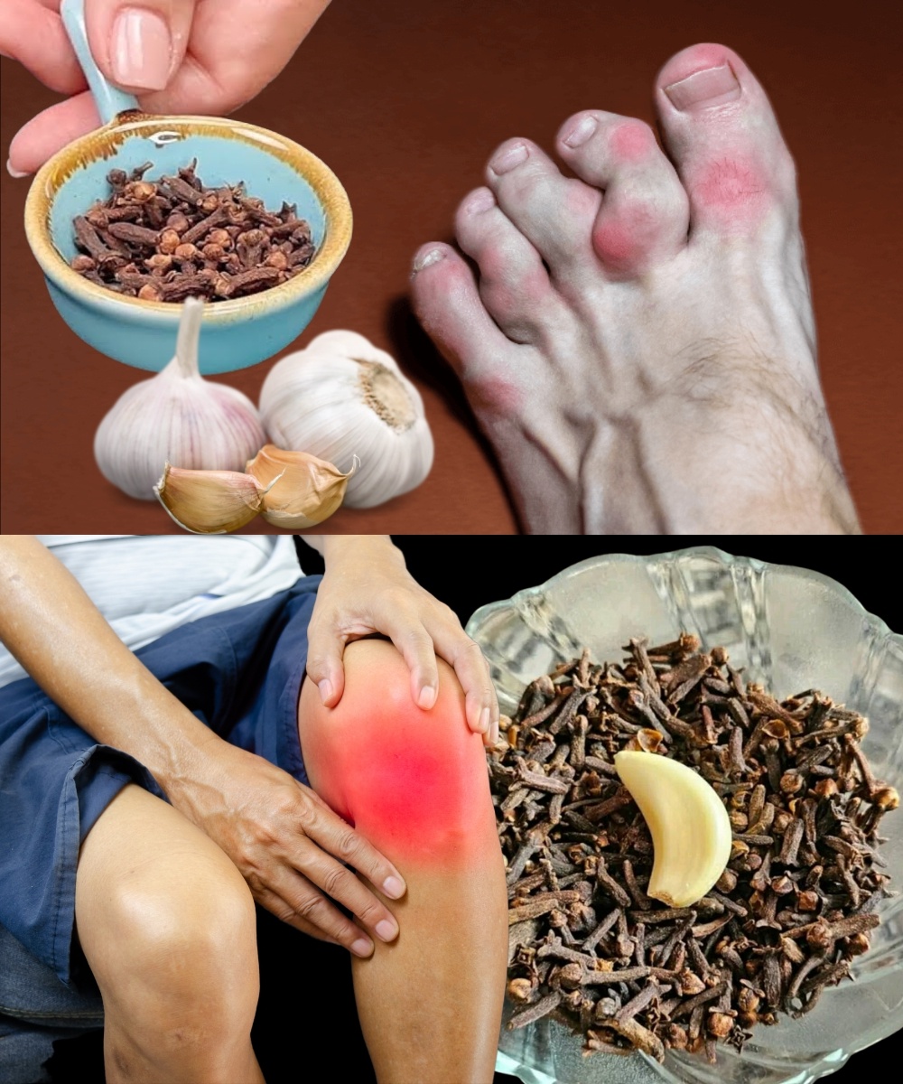 My Mother Couldn’t Walk from the Pain – Until We Tried This Garlic & Clove Oil Remedy