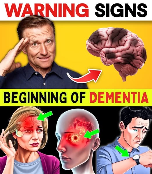 Early Signs of Dementia You Shouldn’t Ignore — And How to Protect Your Brain Naturally